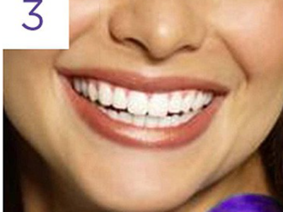 opakowanie pasków wybielających Crest Original